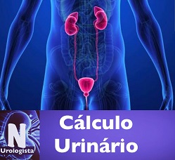 Cálculo Urinário